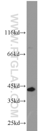 SYCE1 Antibody in Western Blot (WB)