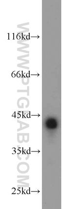 SYCE1 Antibody in Western Blot (WB)