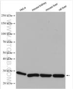 CMBL Antibody in Western Blot (WB)
