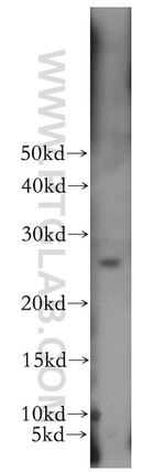 CMBL Antibody in Western Blot (WB)
