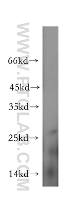 CMBL Antibody in Western Blot (WB)