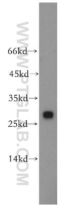 CMBL Antibody in Western Blot (WB)