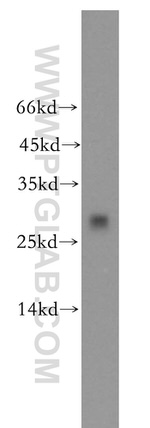 CMBL Antibody in Western Blot (WB)