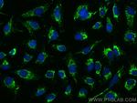 RIOK2 Antibody in Immunocytochemistry (ICC/IF)