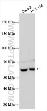 RIOK2 Antibody in Western Blot (WB)