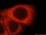 EVI2A Antibody in Immunocytochemistry (ICC/IF)