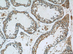 FJX1 Antibody in Immunohistochemistry (Paraffin) (IHC (P))