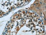 FJX1 Antibody in Immunohistochemistry (Paraffin) (IHC (P))
