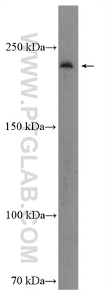 KIF26B Antibody in Western Blot (WB)
