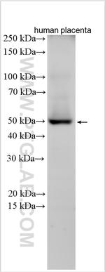 CDK15 Antibody in Western Blot (WB)