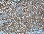 Transferrin Antibody in Immunohistochemistry (Paraffin) (IHC (P))