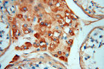 Transferrin Antibody in Immunohistochemistry (Paraffin) (IHC (P))
