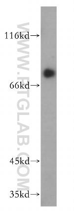 Transferrin Antibody in Western Blot (WB)