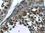 CTAGE6 Antibody in Immunohistochemistry (Paraffin) (IHC (P))