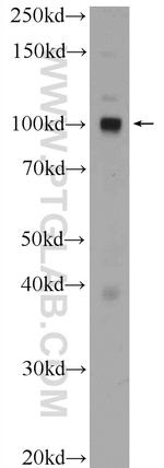 CTAGE6 Antibody in Western Blot (WB)