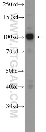 CTAGE6 Antibody in Western Blot (WB)