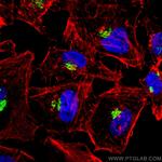 GALNT2 Antibody in Immunocytochemistry (ICC/IF)