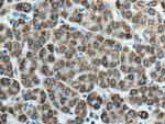 ACADL Antibody in Immunohistochemistry (Paraffin) (IHC (P))