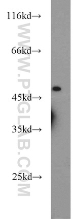 ACADL Antibody in Western Blot (WB)