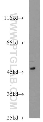 ACADL Antibody in Western Blot (WB)