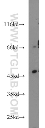 ACADL Antibody in Western Blot (WB)