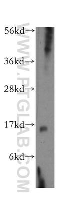 LYZL4 Antibody in Western Blot (WB)