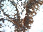 Oligophrenin 1 Antibody in Immunohistochemistry (Paraffin) (IHC (P))