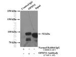 Oligophrenin 1 Antibody in Immunoprecipitation (IP)
