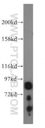 Oligophrenin 1 Antibody in Western Blot (WB)