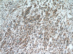 Oligophrenin 1 Antibody in Immunohistochemistry (Paraffin) (IHC (P))
