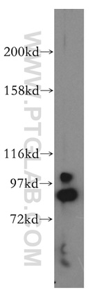 Oligophrenin 1 Antibody in Western Blot (WB)