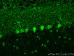 ZNF8 Antibody in Immunohistochemistry (PFA fixed) (IHC (PFA))