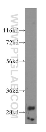 PPIL6 Antibody in Western Blot (WB)