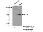TLX3 Antibody in Immunoprecipitation (IP)