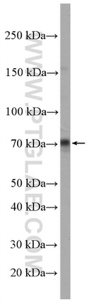 RTKN2 Antibody in Western Blot (WB)