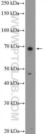 RTKN2 Antibody in Western Blot (WB)