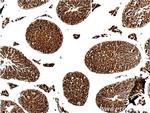 IFT140 Antibody in Immunohistochemistry (Paraffin) (IHC (P))