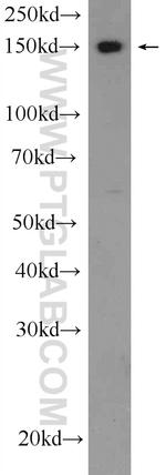 IFT140 Antibody in Western Blot (WB)