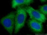Plasminogen Antibody in Immunocytochemistry (ICC/IF)