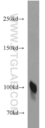 Plasminogen Antibody in Western Blot (WB)