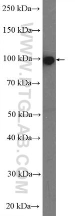 Plasminogen Antibody in Western Blot (WB)