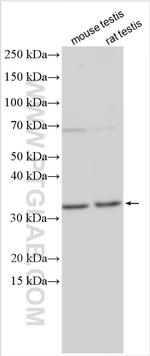 TBC1D21 Antibody in Western Blot (WB)