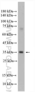 TBC1D21 Antibody in Western Blot (WB)