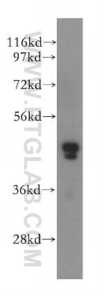 SKAR Antibody in Western Blot (WB)