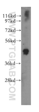SKAR Antibody in Western Blot (WB)
