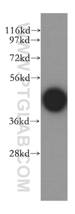 SKAR Antibody in Western Blot (WB)