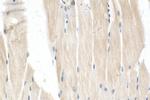 MRPL43 Antibody in Immunohistochemistry (Paraffin) (IHC (P))