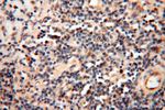 YTHDF1 Antibody in Immunohistochemistry (Paraffin) (IHC (P))
