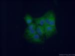 DTD1 Antibody in Immunocytochemistry (ICC/IF)