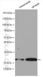 DTD1 Antibody in Western Blot (WB)